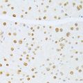 ER81 / ETV1 Antibody - Immunohistochemistry of paraffin-embedded mouse pancreas using ETV1 antibody at dilution of 1:100 (40x lens).