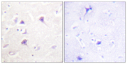 ERBB4 / HER4 Antibody - Immunohistochemistry analysis of paraffin-embedded human brain tissue, using HER4 Antibody. The picture on the right is blocked with the synthesized peptide.