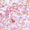 ERCC1 Antibody - Immunohistochemical analysis of ERCC1 staining in human tonsil formalin fixed paraffin embedded tissue section. The section was pre-treated using heat mediated antigen retrieval with sodium citrate buffer (pH 6.0). The section was then incubated with the antibody at room temperature and detected using an HRP conjugated compact polymer system. DAB was used as the chromogen. The section was then counterstained with hematoxylin and mounted with DPX.