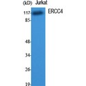 ERCC4 / XPF Antibody - Western blot of ERCC4 antibody