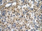 ERG1 / SQLE Antibody - SQLE antibody SQLE(squalene epoxidase) Antibody was used in IHC to stain formalin-fixed, paraffin-embedded human liver.  This image was taken for the unconjugated form of this product. Other forms have not been tested.