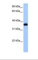 ERI2 / EXOD1 Antibody - Jurkat cell lysate. Antibody concentration: 1.0 ug/ml. Gel concentration: 12%.  This image was taken for the unconjugated form of this product. Other forms have not been tested.