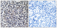ERIC-1 / TACC3 Antibody - Immunohistochemistry analysis of paraffin-embedded human tonsil tissue, using TACC3 Antibody. The picture on the right is blocked with the synthesized peptide.