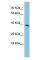 ERICH1 Antibody - ERICH1 antibody Western Blot of Fetal Liver. Antibody dilution: 1 ug/ml.  This image was taken for the unconjugated form of this product. Other forms have not been tested.