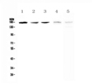 ERN1 / IRE1 Antibody - Western blot - Anti-IRE1 Picoband antibody