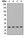 ERVFRD-1 / HERV-FRD Antibody - Western blot analysis of Syncytin-2 expression in HT29 (A); A549 (B); K562 (C); mouse liver (D) whole cell lysates.