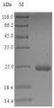 lpp Protein - (Tris-Glycine gel) Discontinuous SDS-PAGE (reduced) with 5% enrichment gel and 15% separation gel.