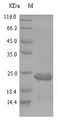 Carbon storage regulator Protein - (Tris-Glycine gel) Discontinuous SDS-PAGE (reduced) with 5% enrichment gel and 15% separation gel.