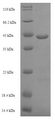 lepB Protein - (Tris-Glycine gel) Discontinuous SDS-PAGE (reduced) with 5% enrichment gel and 15% separation gel.