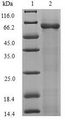 rtcB / RNA-Splicing Ligase Protein - (Tris-Glycine gel) Discontinuous SDS-PAGE (reduced) with 5% enrichment gel and 15% separation gel.