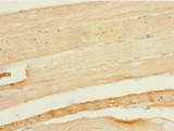 ESE3 / EHF Antibody - Immunohistochemistry of paraffin-embedded human skeletal muscle tissue at dilution 1:100
