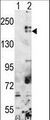 ESET / SETDB1 Antibody - Western blot of SETDB1(arrow) using rabbit polyclonal SETDB1 Antibody. 293 cell lysates (2 ug/lane) either nontransfected (Lane 1) or transiently transfected with the SETDB1 gene (Lane 2) (Origene Technologies).