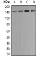 ESET / SETDB1 Antibody - Western blot analysis of ESET expression in MCF7 (A); HeLa (B); A549 (C); HepG2 (D) whole cell lysates.