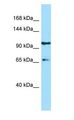 ESF1 Antibody - ESF1 antibody Western Blot of MCF7.  This image was taken for the unconjugated form of this product. Other forms have not been tested.
