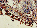 ESM1 / Endocan Antibody - Immunohistochemistry of paraffin-embedded human lung tissue at dilution of 1:100