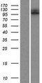 ESPNL Protein - Western validation with an anti-DDK antibody * L: Control HEK293 lysate R: Over-expression lysate