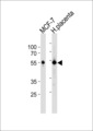 ESR2 / ER Beta Antibody - ESR2 Antibody western blot of MCF-7 cell line and human placenta tissue lysates (35 ug/lane). The ESR2 antibody detected the ESR2 protein (arrow).