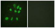 ESR2 / ER Beta Antibody - Immunofluorescence analysis of HeLa cells, using Estrogen Receptor-beta Antibody. The picture on the right is blocked with the synthesized peptide.