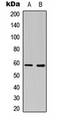 ESR2 / ER Beta Antibody - Western blot analysis of Estrogen Receptor beta expression in COLO205 (A); NIH3T3 (B) whole cell lysates.