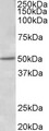 ESR2 / ER Beta Antibody - ESR2 antibody (1 ug/ml) staining of Human Placenta lysate (35 ug protein in RIPA buffer). Primary incubation was 1 hour. Detected by chemiluminescence.