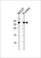 ESRG Antibody - Western blot analysis of lysates from NCCIT cell line and human ovary tissue lysate (from left to right), using HESRG Antibody (Center). HESRG Antibody (Center) was diluted at 1:1000 at each lane. A goat anti-rabbit IgG H&L (HRP) at 1:5000 dilution was used as the secondary antibody. Lysates at 35ug per lane.