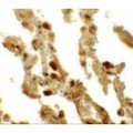 ESRP2 / RBM35B Antibody - Immunohistochemistry of RBM35B in human lung tissue with RBM35B antibody at 5 µg/mL.