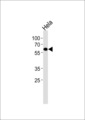 ESRRG / ERR Gamma Antibody - ESRRG Antibody western blot of HeLa cell line lysates (35 ug/lane). The ESRRG antibody detected the ESRRG protein (arrow).