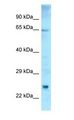 ETFDH Antibody - ETFDH antibody Western Blot of Fetal Thymus.  This image was taken for the unconjugated form of this product. Other forms have not been tested.