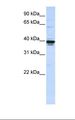 ETV3L Antibody - Jurkat cell lysate. Antibody concentration: 1.0 ug/ml. Gel concentration: 12%.  This image was taken for the unconjugated form of this product. Other forms have not been tested.