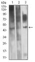 EVI2B Antibody - Western blot analysis using CD361 mouse mAb against HL-60 (1), Raji (2), and PC-12 (3) cell lysate.