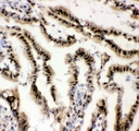 EWSR1 / EWS Antibody - IHC analysis of EWSR1 using anti-EWSR1 antibody. EWSR1 was detected in frozen section of rat intestine tissues. Heat mediated antigen retrieval was performed in citrate buffer (pH6, epitope retrieval solution) for 20 mins. The tissue section was blocked with 10% goat serum. The tissue section was then incubated with 1µg/ml rabbit anti-EWSR1 Antibody overnight at 4°C. Biotinylated goat anti-rabbit IgG was used as secondary antibody and incubated for 30 minutes at 37°C. The tissue section was developed using Strepavidin-Biotin-Complex (SABC) with DAB as the chromogen.