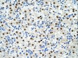 EXOSC4 / RRP41 Antibody - EXOSC4 antibody ARP40935_T100-NP_061910-EXOSC4 (exosome component 4) Antibody was used in IHC to stain formalin-fixed, paraffin-embedded human liver.  This image was taken for the unconjugated form of this product. Other forms have not been tested.