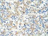 EXOSC6 Antibody - EXOSC6 antibody ARP41087_T100-NP_478126-EXOSC6 (exosome component 6) Antibody was used in IHC to stain formalin-fixed, paraffin-embedded human liver.  This image was taken for the unconjugated form of this product. Other forms have not been tested.