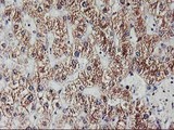 EXOSC7 Antibody - IHC of paraffin-embedded Human liver tissue using anti-EXOSC7 mouse monoclonal antibody.