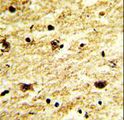 EXOSC8 Antibody - Formalin-fixed and paraffin-embedded human brain tissue with EXOSC8 Antibody , which was peroxidase-conjugated to the secondary antibody, followed by DAB staining. This data demonstrates the use of this antibody for immunohistochemistry; clinical relevance has not been evaluated.