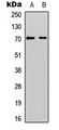 EYA1 Antibody - Western blot analysis of EYA1 expression in A549 (A); H9C2 (B) whole cell lysates.