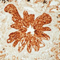 EZR / Ezrin Antibody - Formalin-fixed, paraffin-embedded human lung stained with peroxidase-conjugate and DAB chromogen. Note cell membrane staining of bronchioepithelial cells. This image was taken for the unmodified form of this product. Other forms have not been tested.