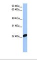 F10 / Factor X Antibody - 721_B cell lysate. Antibody concentration: 1.0 ug/ml. Gel concentration: 12%.  This image was taken for the unconjugated form of this product. Other forms have not been tested.
