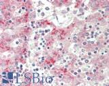 F13B / TGase Antibody - Human Fetal Liver: Formalin-Fixed, Paraffin-Embedded (FFPE).  This image was taken for the unconjugated form of this product. Other forms have not been tested.