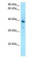 F2RL1 / PAR2 Antibody - F2RL1 / PAR2 antibody Western Blot of MCF7.  This image was taken for the unconjugated form of this product. Other forms have not been tested.