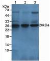 F3 / CD142 / Tissue factor Antibody - Western Blot; Sample: Lane1: Rabbit Thymus Testis; Lane2: Rabbit Testis Tissue; Lane3: Rabbit Lung Tissue.