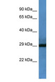 F7 / Factor VII Antibody - F7 / Factor VII antibody Western blot of COL0205 Cell lysate. Antibody concentration 1 ug/ml.  This image was taken for the unconjugated form of this product. Other forms have not been tested.