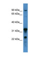 F8 / FVIII / Factor VIII Antibody - F8 / Factor VIII antibody Western blot of 721_B cell lysate.  This image was taken for the unconjugated form of this product. Other forms have not been tested.