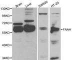 FAAH Antibody - Western blot of FAAH pAb in extracts from mouse brain, liver tissues and SW620, HT-29 cells.