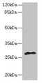 fabI Antibody - Western blot All lanes: fabI antibody at 5µg/ml + Mouse heart tissue Secondary Goat polyclonal to rabbit IgG at 1/10000 dilution Predicted band size: 28 kDa Observed band size: 28 kDa