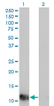 FABP1 / L-FABP Antibody - Western Blot analysis of FABP1 expression in transfected 293T cell line by FABP1 monoclonal antibody (M01), clone 4G5.Lane 1: FABP1 transfected lysate(14.2 KDa).Lane 2: Non-transfected lysate.