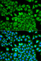 FABP1 / L-FABP Antibody - Immunofluorescence analysis of MCF-7 cell using FABP1 antibody. Blue: DAPI for nuclear staining.