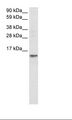 FABP7 / BLBP / MRG Antibody - Fetal Brain Lysate.  This image was taken for the unconjugated form of this product. Other forms have not been tested.