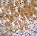 FAH Antibody - FAH Antibody immunohistochemistry of formalin-fixed and paraffin-embedded human liver tissue followed by peroxidase-conjugated secondary antibody and DAB staining.