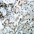 FAH Antibody - Immunohistochemical analysis of Fumarylacetoacetase staining in rat kidney formalin fixed paraffin embedded tissue section. The section was pre-treated using heat mediated antigen retrieval with sodium citrate buffer (pH 6.0). The section was then incubated with the antibody at room temperature and detected using an HRP conjugated compact polymer system. DAB was used as the chromogen. The section was then counterstained with hematoxylin and mounted with DPX.